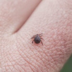 Tick bites on the rise: How to stay safe as you head outdoors