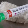 Monkeypox in Delhi: Nigerian man tests positive for monkeypox; 2nd case in Delhi, 6th in India | Delhi News